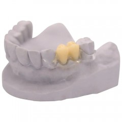 dentona vivatemp®