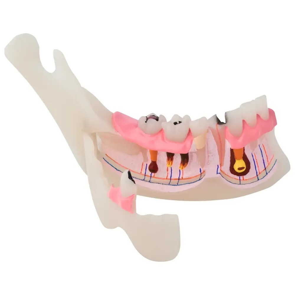 Pathologisches halbes UK Modell P13-TR10
