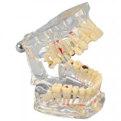 Studienmodell Transparent De Luxe